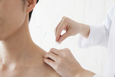 lady  getting acupuncture treatment