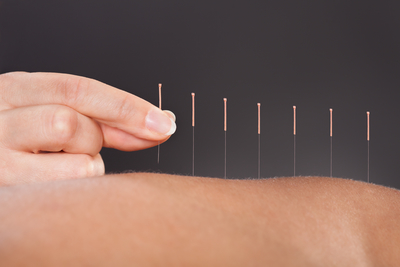 Acupuncture Benefits